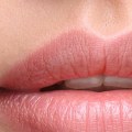 Which Facial Fillers Last the Longest?