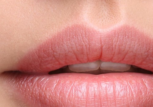 Which Facial Fillers Last the Longest?