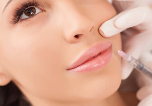 Which Facial Fillers Last the Longest?